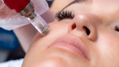 Microneedling has gained significant popularity in recent years as a minimally invasive cosmetic procedure designed to enhance skin